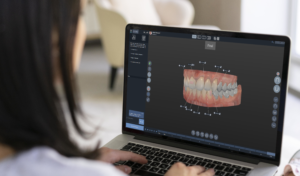 Dentist using Vitaware OrthoLab chairside aligner system software to plan treatment with Clear Aligners