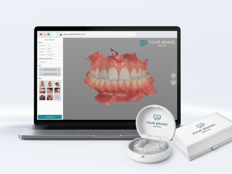 Aligner Brand